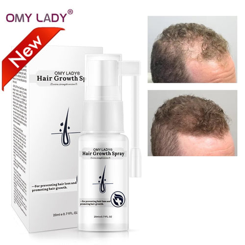 OMYLADY Hair Growth Liquid  Essential Oil Serum Original Authentic 100% Hair Loss Anti-hair loss Dense Hair Growth  Care new