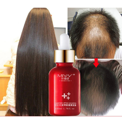 New 30ML Hair Growth Essence Oils Advanced Thinning Hair & Hair Loss Supplement Beauty Support Anti-off Hair Care Solution